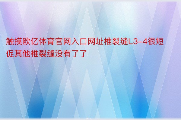 触摸欧亿体育官网入口网址椎裂缝L3-4很短促其他椎裂缝没有了了